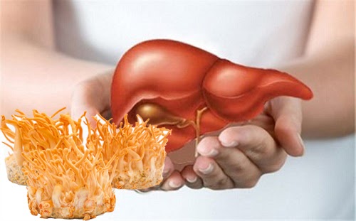 Gan Nhiem Mo La Gi Hieu Ro Va Cach Phong Tranh Can Benh Tiem An Nguy Hiem 68fede5b400d9.jpg