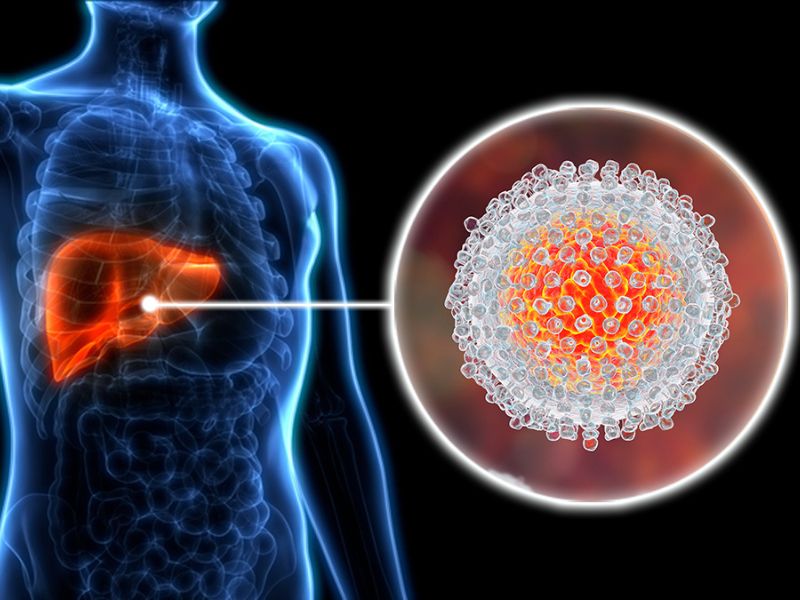 Nguyen Nhan Viem Gan Nhung Yeu To Gay Benh Tiem An Ma Ban Can Biet 68fee2d3de66a.png