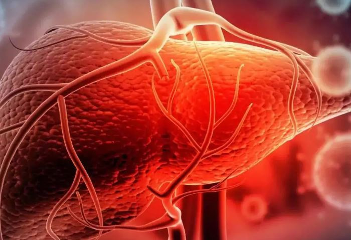 Viêm gan là gì - Hiểu rõ về căn bệnh nguy hiểm có thể gặp phải Viêm gan là gì - Hiểu rõ về căn bệnh nguy hiểm có thể gặp phải