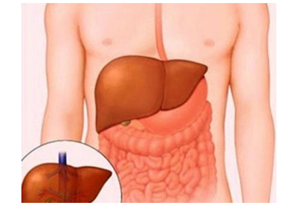 Bệnh gan có lây qua đường ăn uống không - Cẩm nang hiểu biết về khả năng truyền nhiễm và phòng tránh hiệu quả