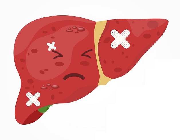 Cách phòng ngừa ung thư gan hiệu quả - Bước đi vững chắc giữ gìn sức khỏe lâu dài