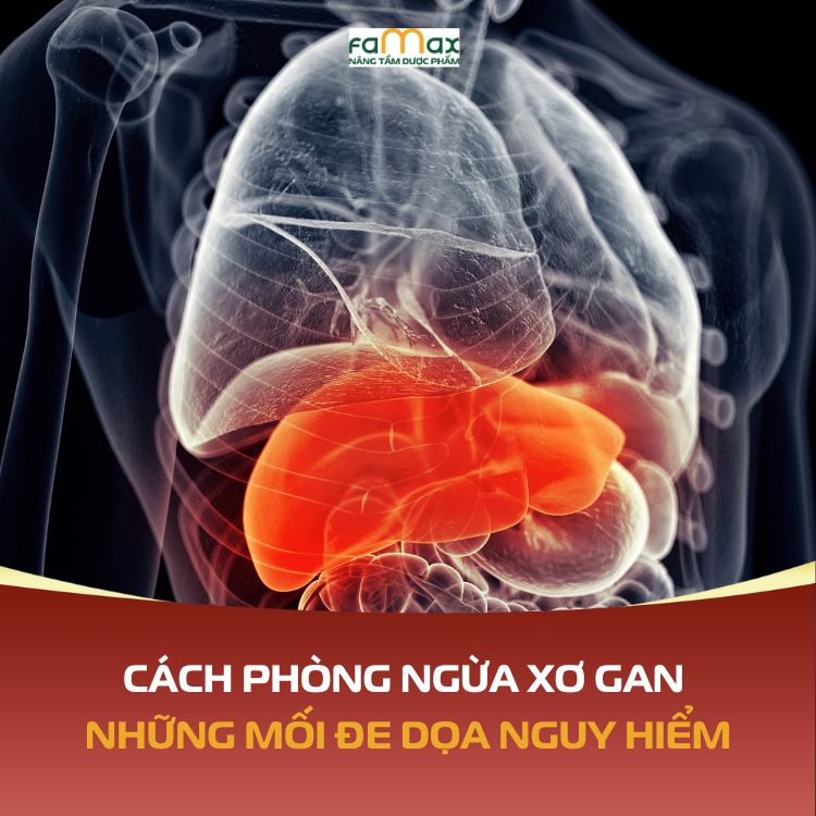Cach Phong Ngua Xo Gan Bi Quyet Giu Gin La Gan Khoe Manh Tu Som 6921348852605.webp