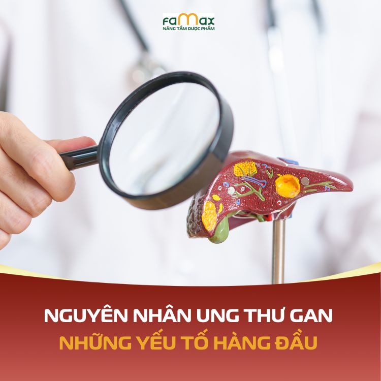 Nguyen Nhan Ung Thu Gan Nhung Yeu To Hang Dau De Doa Suc Khoe Cua Ban 690da583beefd.webp