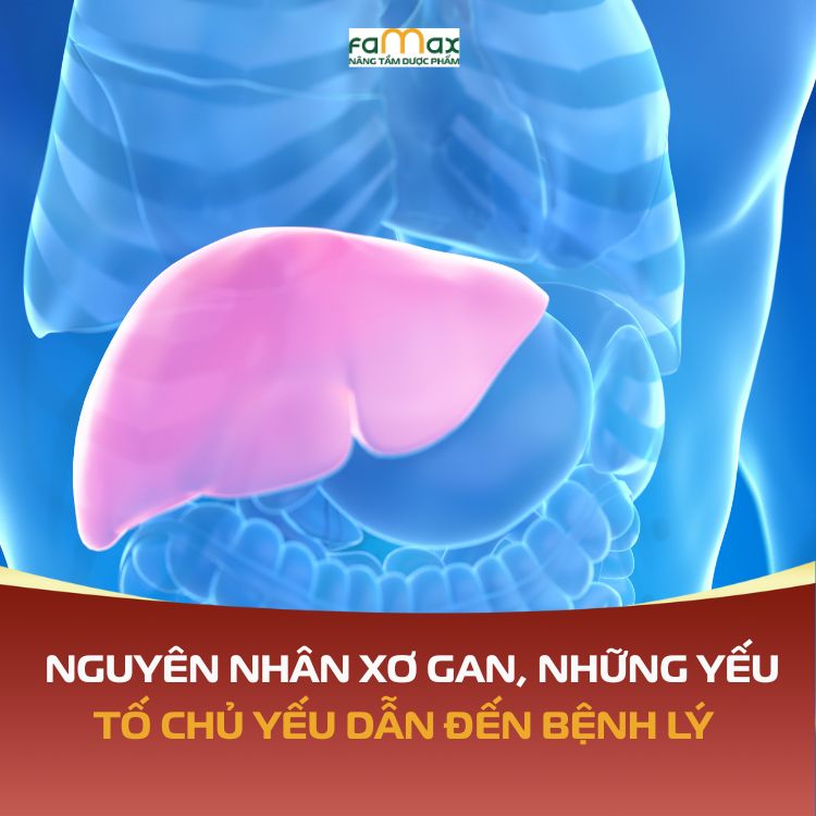 Nguyen Nhan Xo Gan Nhung Yeu To Chu Yeu Dan Den Benh Ly Nguy Hiem Nay 690d709422146.webp