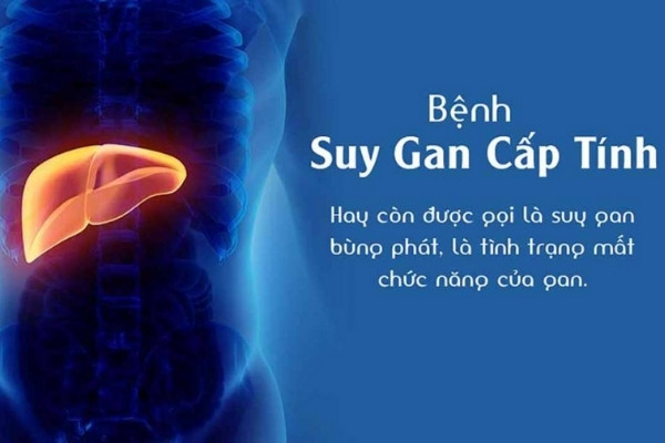 Suy gan có chữa được không? Khám phá khả năng hồi phục của bệnh lý nguy hiểm này