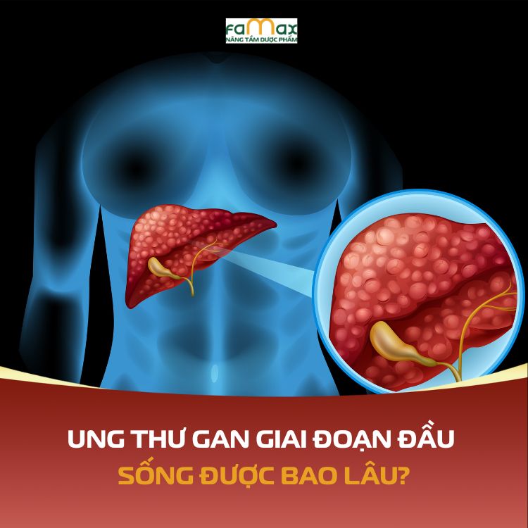 Ung Thu Gan Giai Doan Dau Song Duoc Bao Lau 6917edc05d7d6.webp