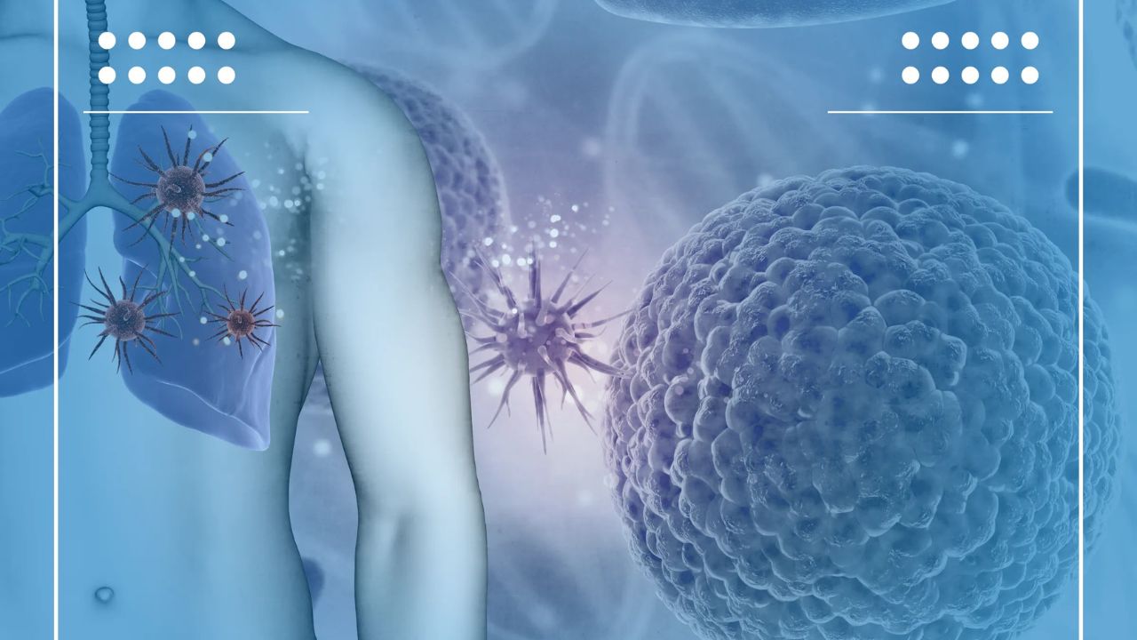 Ung thư gan giai đoạn đầu sống được bao lâu - Cơ hội chữa trị và ý nghĩa của việc phát hiện sớm