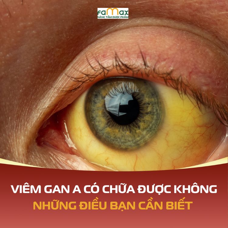 Viem Gan A Co Chua Duoc Khong 6928fe9926300.webp