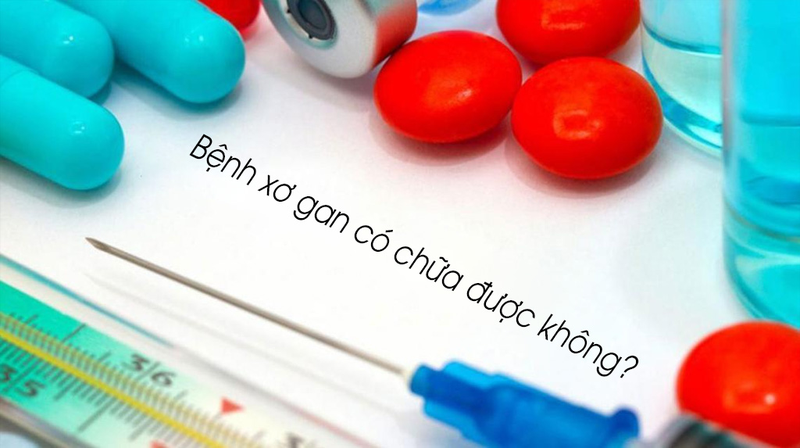 Xơ gan có chữa được không - Khám phá khả năng điều trị và hướng đi mới cho bệnh nhân