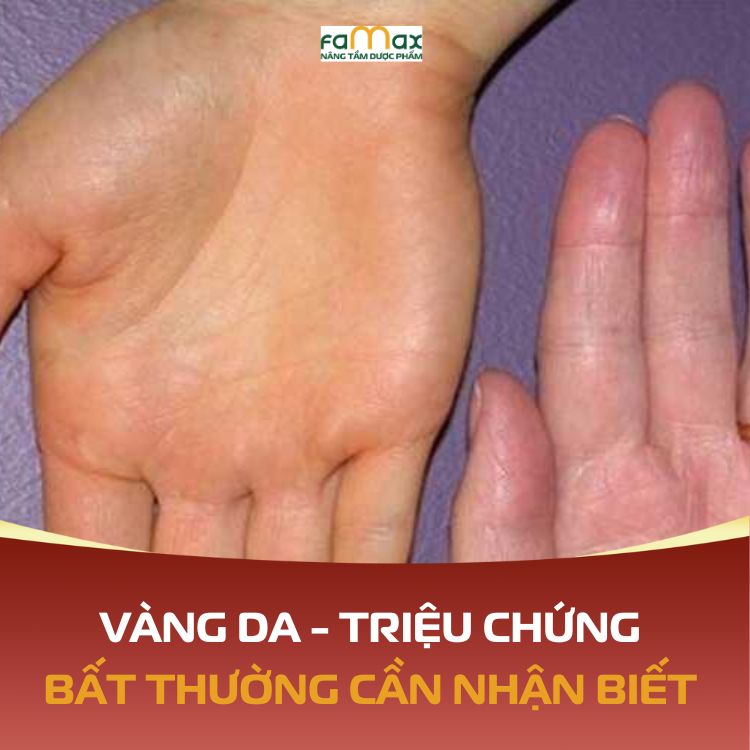 Vang Da Trieu Chung Bat Thuong Can Nhan Biet Va Cach Xu Ly Dung Dan 69328fad3e1a9.webp