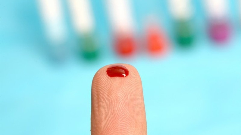 Viêm gan B có bị lây không? Những điều bạn cần biết để bảo vệ chính mình và người thân